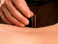 points-acupuncture