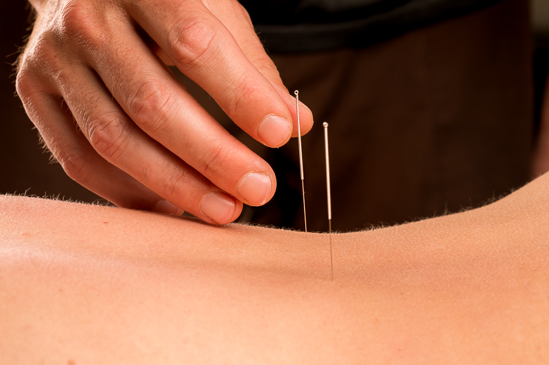 Les points d'acupuncture pour retrouver son énergie vitale